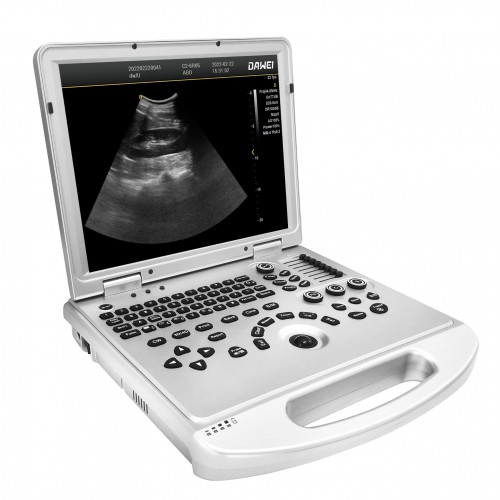 DIAGNOSTIC ULTRASOUND DEVICE